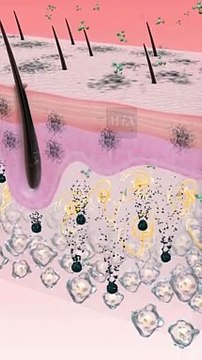 Blackheads | Causes of clogged pores #mix #blackheads_cause