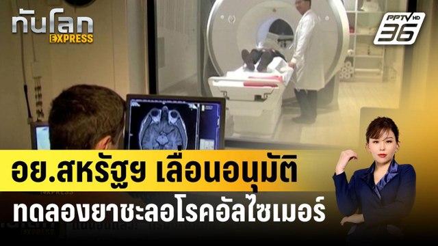 อย.สหรัฐฯ เลื่อนอนุมัติ ทดลองยาชะลอโรคอัลไซเมอร์ตัวใหม่ | ทันโลก EXPRESS | 10 มี.ค. 67