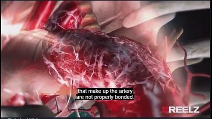 John Ritter and Jeffrey Epstein Autopsies