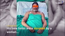 Indian Man Gets New Hands in Rare Double Transplant Procedure