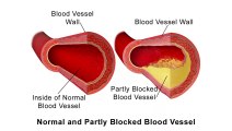 Unveiling The Mystery(How Doctors Diagnose Heart Failure)