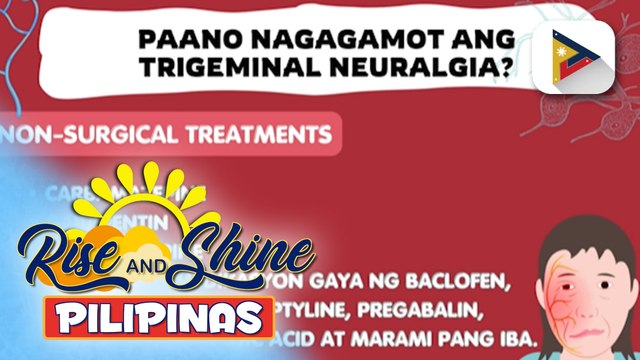 SAY ni DOK | Ano ang trigeminal neuralgia, ano ang sanhi, sintomas at gamot nito