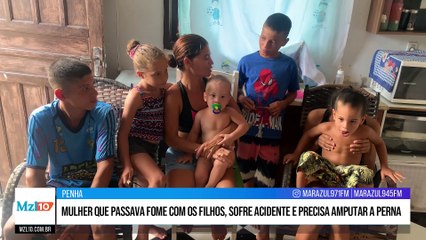 Mulher que passava fome com os filhos, sofre acidente e precisa amputar a perna