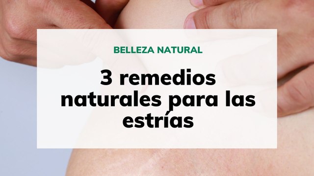 3 remedios naturales para las estrías