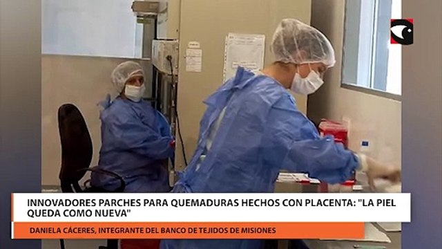 Innovadores parches para quemaduras hechos con placenta: La piel queda como nueva