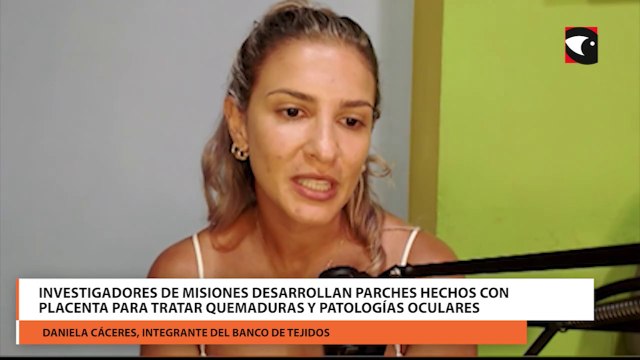 Desarrollan en Misiones parches hechos con placenta para quemaduras y patologías oculares