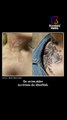 Cicatrices, brûlures, scarifications : Marty est tatoueuse et fait du tatouage réparateur | Good Job