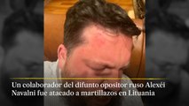 Atacan a martillazos a un colaborador del opositor ruso Alexéi Navalni