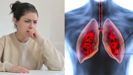 Descargar video: लंग्स इन्फेक्शन में क्या खाना चाहिए | Lungs Infection Me Kya Khana Chahiye Kya Nahi | Boldsky