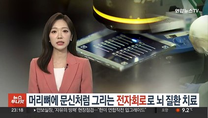 머리뼈에 문신처럼 그리는 전자회로로 뇌 질환 치료한다