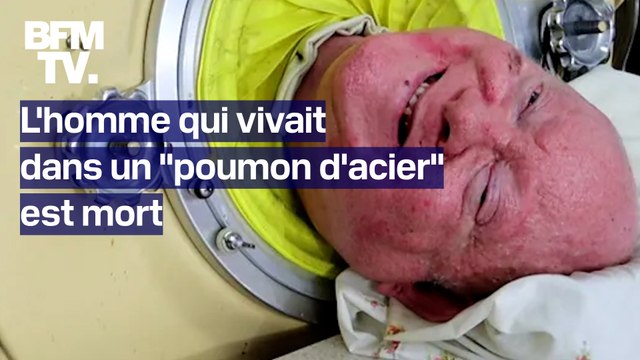États-Unis: l'homme qui vivait dans un poumon de fer à cause de la polio depuis 7 ans est mort