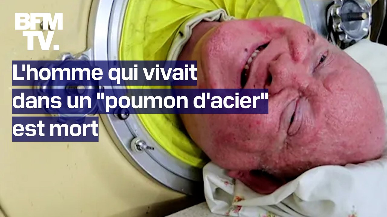 États-Unis: l'homme qui vivait dans un "poumon de fer" à cause de la polio depuis 7 ans est mort