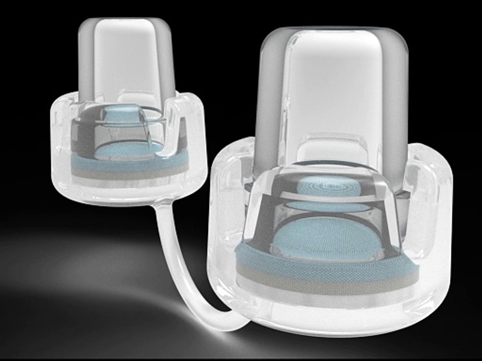 Dispositivo intranasal