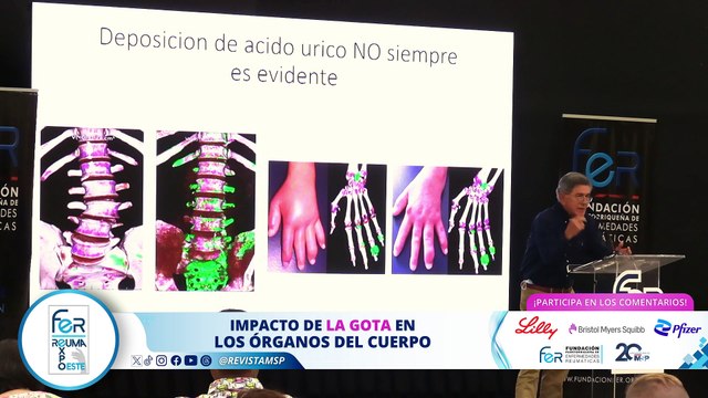 Reuma Expo Oeste: Lo más relevante de la reumatología - Parte 2 #ExclusivoMSP