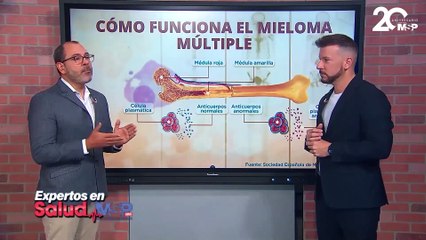 ¿Cómo funciona el mieloma múltiple o cáncer de células plasmáticas? - #ExclusivoMSP