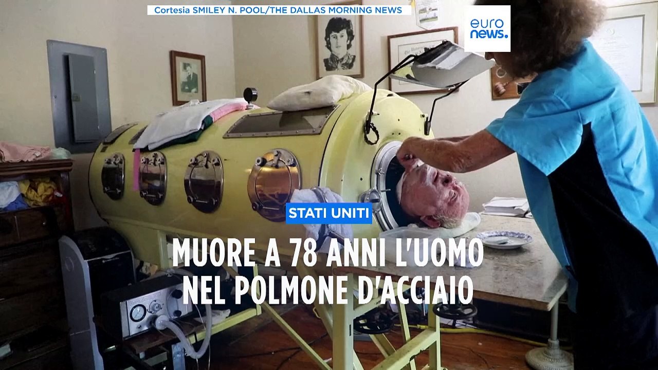 È morto a 78 anni Paul Alexander, l'uomo che ha trascorso tutta la sua vita in un polmone d'acciaio