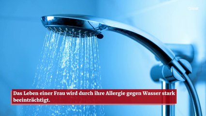Frau kann wegen einer seltenen Wasserallergie nicht duschen