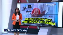 Kronologi Kasus Bagian Tubuh Bayi Tertinggal di Rahim Ibu saat Melahirkan