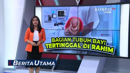 Kronologi Kasus Bagian Tubuh Bayi Tertinggal di Rahim Ibu saat Melahirkan