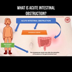 What is acute intestinal obstruction?