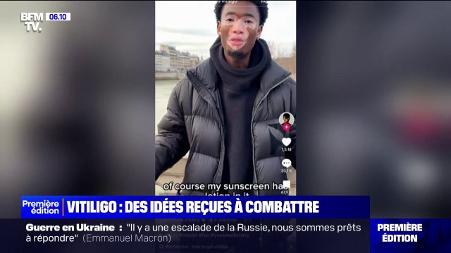 Ni grave, ni contagieux... comment combattre les idées reçues sur le vitiligo