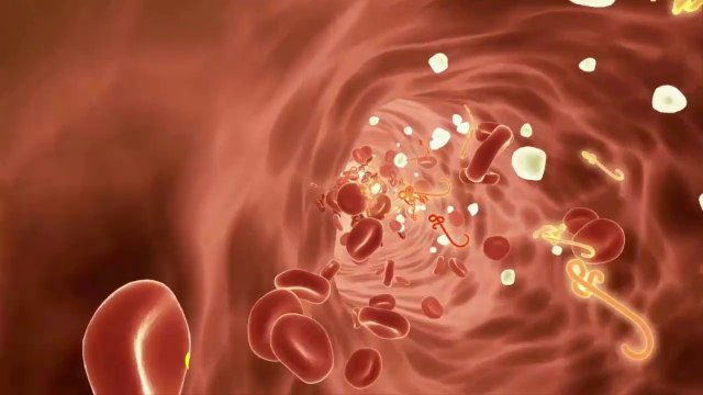 Top 7 Foods that Unclog Arteries Naturally and Prevent Heart Attack