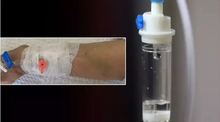 Damar yolu ile verilen serumda mikroplastik çıktı