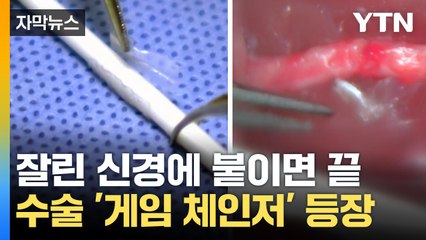 [자막뉴스] 밴드 감았더니 신경 회복...수술 '게임 체인저' 전망 / YTN
