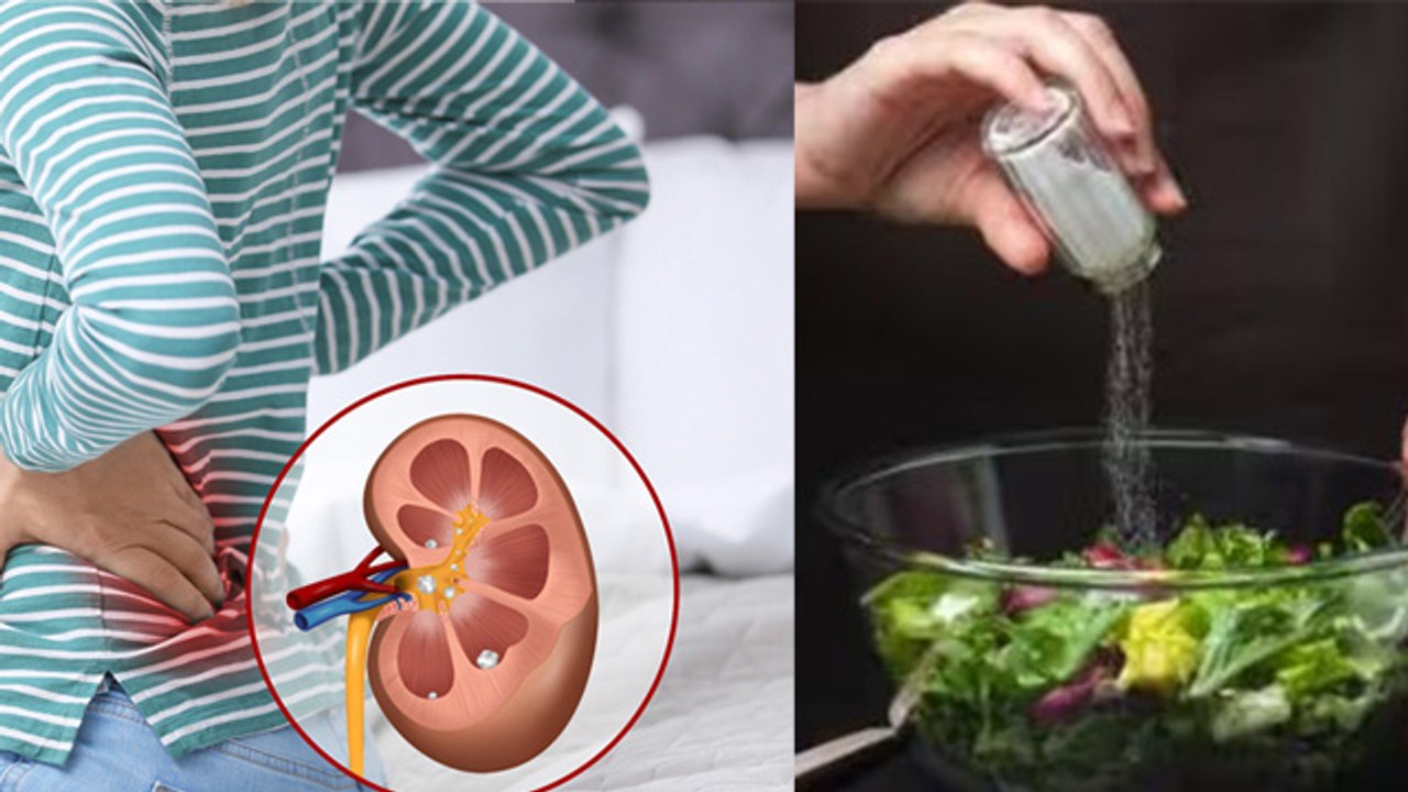 पथरी गलाने के लिए क्या खाना चाहिए | Kidney Stone Dissolve Food | Boldsky