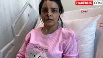 Marmaray İstasyonu'nda saldırıya uğrayan kadın yüzündeki 40 dikişle dehşet dolu anları anlattı