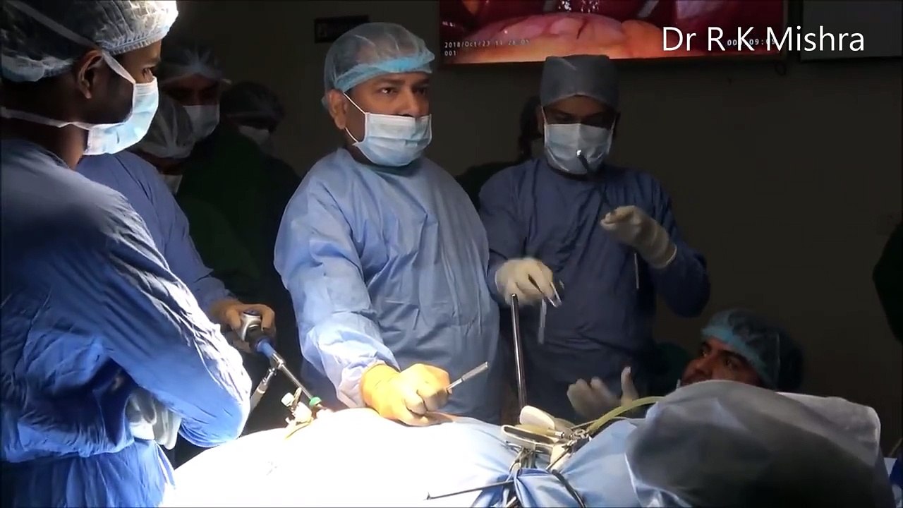 Bariatric Surgery Laparoscopic sleeve Gastrectomy Step by Step Video by Dr R K Mishra