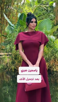 النجمات قبل وبعد تجميل الأنف .. تغيير جذري في الملامح