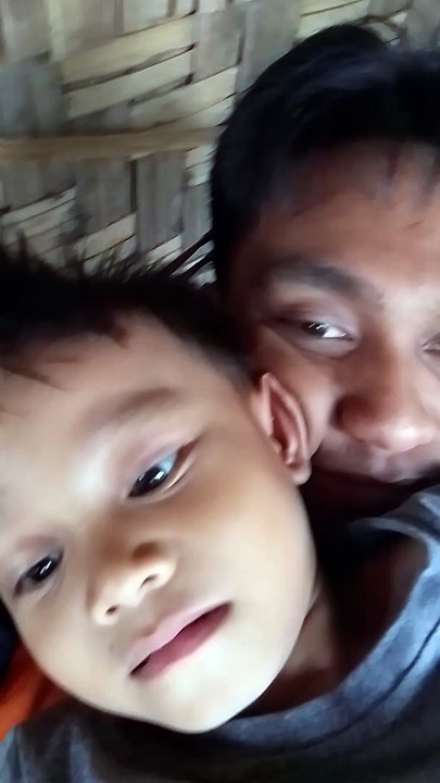 igsuun
