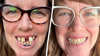"My crooked teeth made me look like a shark - now I'm a completely different person"