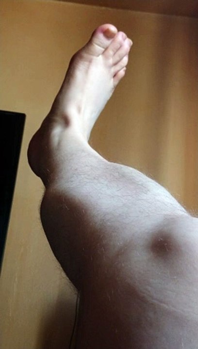 Me Trying To Fix Ankle