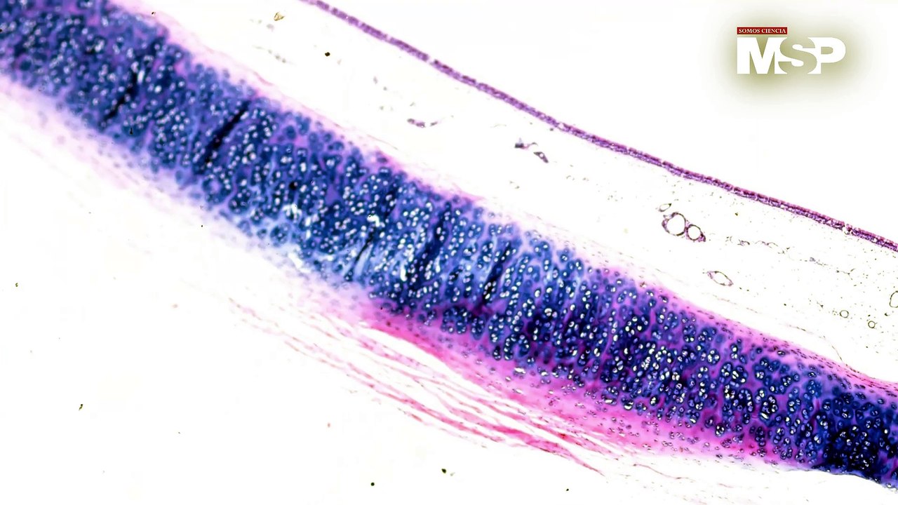 Endometriosis: ¿Cómo funciona a nivel celular y cómo afecta los tejidos? - #ExclusivoMSP