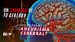 Un peligroso enemigo de tu cerebro: ¿Cómo se forma un aneurisma cerebral? - #ExclusivoMSP