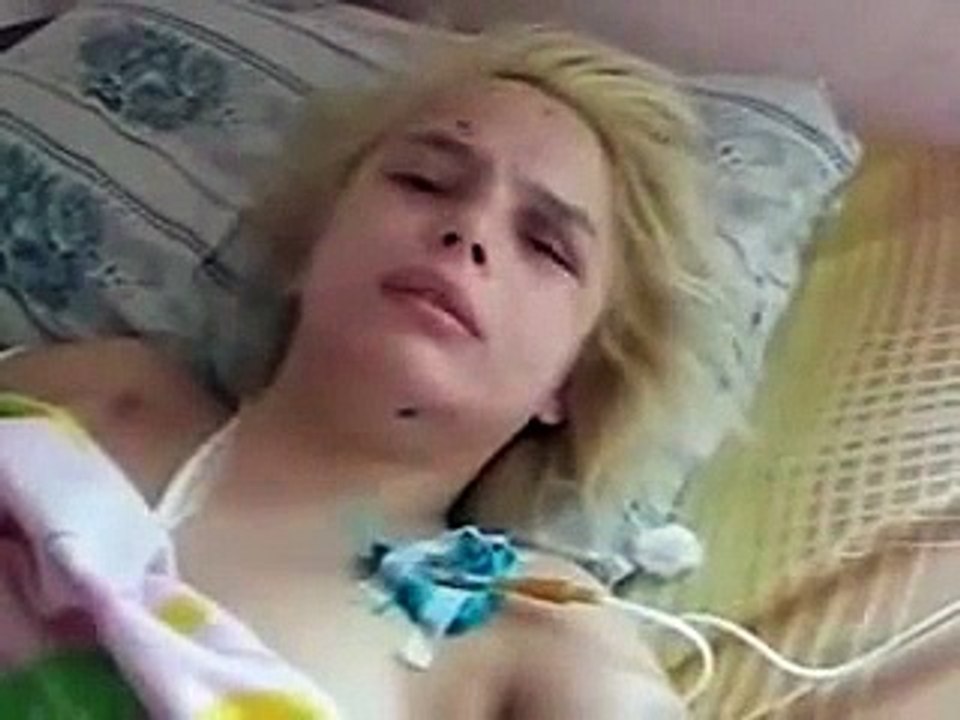 Oksana Makar GangRaped Ukraine teen allegedly burnt and left in a ditch Dies in Hopsital - Vídeo Dailymotion