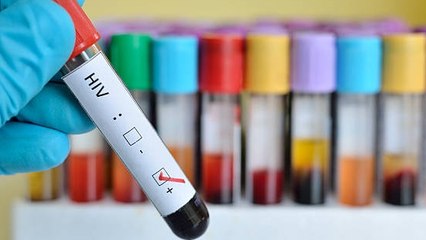 Tratamiento Contra El VIH: Ya Se Puede Eliminar El Virus De Las Células
