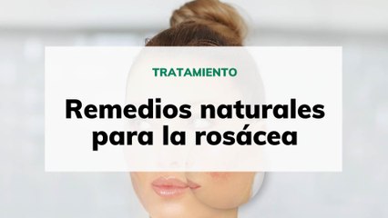 Remedios naturales para la rosácea