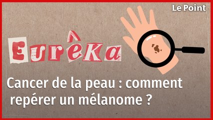 Cancer de la peau : comment repérer un mélanome ?