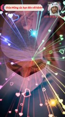 Bác sĩ Nga lập kỷ lục cắt bỏ 170 khối u ung thư qua 6 lần phẫu thuật