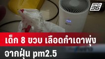 เด็ก 8 ขวบ เลือดกำเดาพุ่งจากฝุ่น pm2.5 | เที่ยงทันข่าว | 21 มี.ค. 67