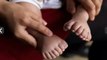 Niño nació con 31 dedos en China: padres hacen desesperado pedido