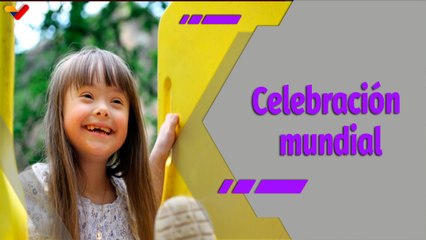 Al Día | Trisomía 21 mitos y verdades