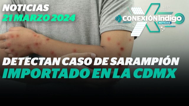 Detecta Secretaría de Salud en la CDMX un caso importado de sarampión | Reporte Indigo