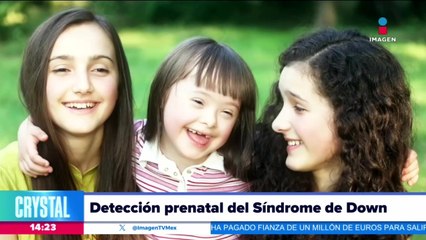 Síndrome de Down: ¿Qué es? Especialista habla del tema