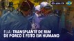 Médico brasileiro realiza primeiro transplante de rim de porco em humano