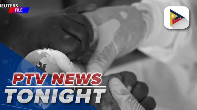 DOH to not impose lockdowns for mpox