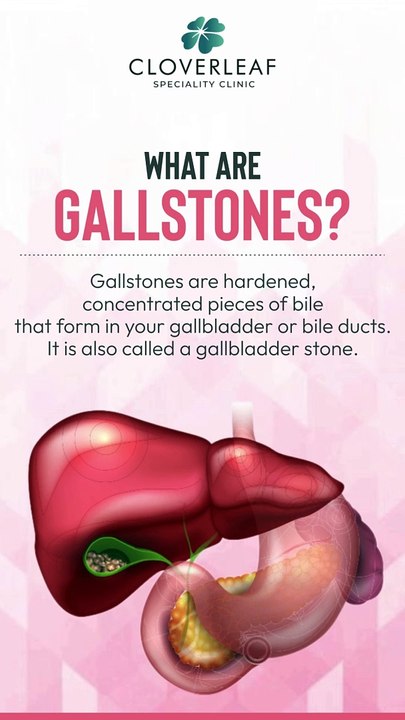 gallbladder